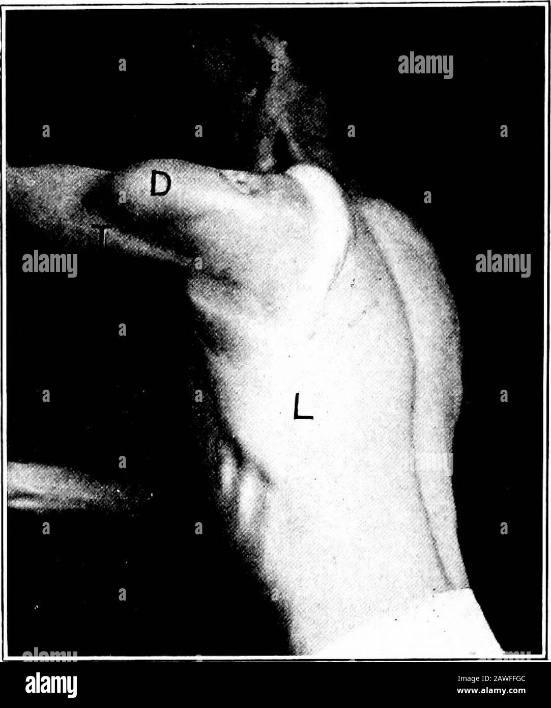 Applied anatomy and kinesiology, the mechanism of muscular movement ...