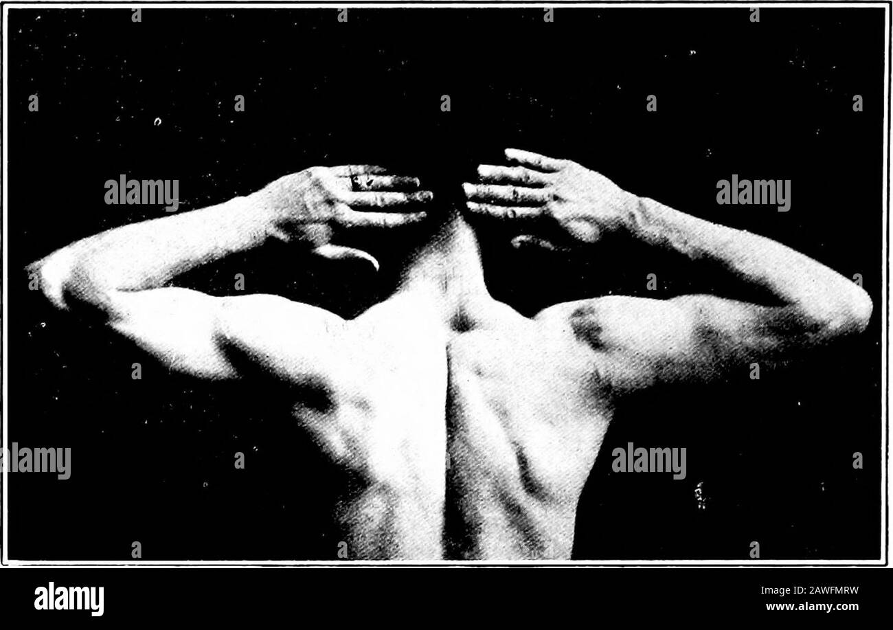 Arm abduction Black and White Stock Photos & Images Alamy
