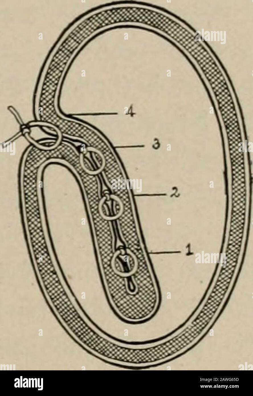Operative surgery, for students and practitioners . Fig. 163.—Cross