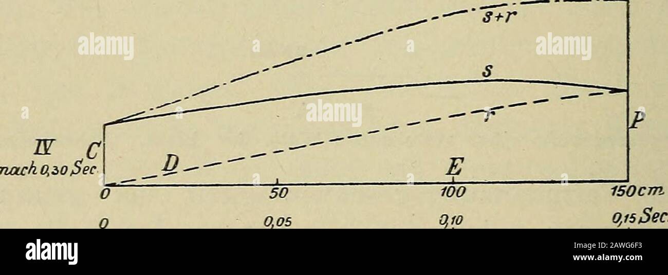 Die Untersuchung des Pulses und ihre Ergebnisse in gesunden und kranken Zuständen . ch.0,15 D 0 s+r sSefi S- - 50 100 150 &gt;p. Fig. 77. Entwicklung der systolischen Welle (Fig. 76) in einem Schlauch (Arterie) von 150 cm Länge unter den im Text angegebenen Bedingungen. ursprüngliche Welle im Moment 0,15 bei P in die Arterie eintretenund mit der Geschwindigkeit von 10 m sich ausbreiten würde. Um für den Zeitpunkt 0,2 See. zu wissen, welcher Druck an denverschiedenen Querschnitten der Arterie vorhanden ist, braucht mannur die Welle (s) um 0,05 See. von C nach P zu verschieben, das überC hin Stock Photo