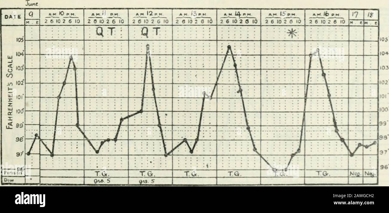 Annals of tropical medicine and parasitology . 6 10 2 0 10 q ° n 12 13 14 IS lb 7 g iq 20 ?21 21 23 24 25 2fc M e h-- M e M e M e M E M . e n E M p ri G K E M E M e M C M E H £ M E M C ^^ t Jl h 4 ^^ -J f —A A 7 T j vv ..^.?.-fT^ ,/ 7 / d 1-i ... r A A A &gt; / i A l: i y V: H i v / iL ^ L / jH t 1/ A 2 ; f- r- r- 10. 1. TO. TG. T.G. T.G. T.G. T T. T T. N«q Ne^^ T T Tr, Tr^ TCt TCr TO T Tft B„u li^ 0ij5  ^  ^ -J Ca.e 915 Titft DATE 3 4 »« 5 P- b 2 6 10 2 6 10 8 -±J^ 9 ».- /o II 12. 13 14 15 /fe 17 la 19 20 21 22 23 .M 24p„ 25 «1 £ H £ M e M E M e H e M . E M . E M E M , E M e M £ M E M Stock Photo