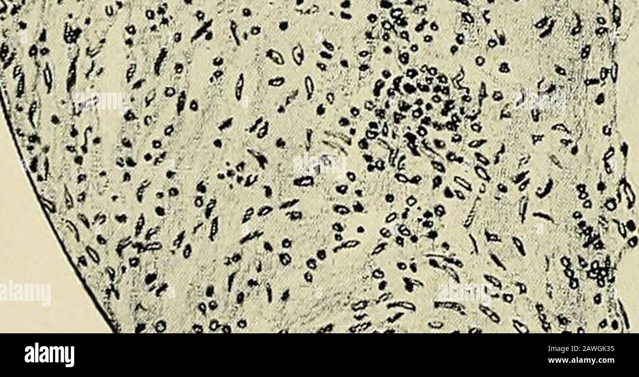 Dense fibrous connective tissue hi-res stock photography and images - Alamy