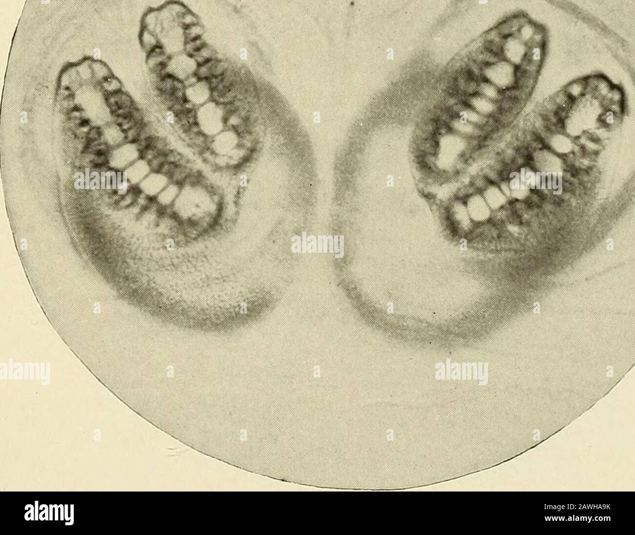 Annual Report X 3fr 1 A Queen Blowfly Larvae Plate 6 237 Queen Blow Fly Phormia Regina Meig I Portion Of Transverse Band Of Chitinous Points Greatly Enlarged X 0 2 One Posterior Spiracle