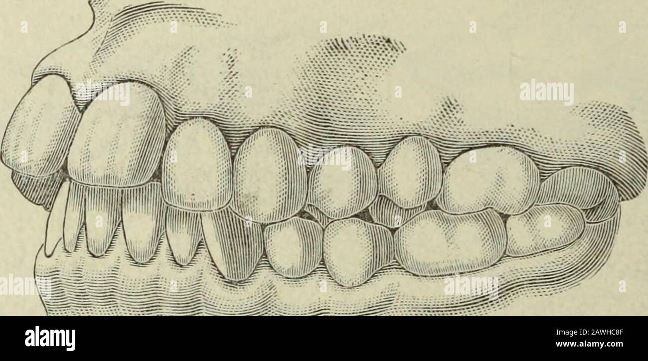 The Dental cosmos. Skull of bulldog. shows a pig which won first prize as  the the express purpose of coursing the hare, best white hog at a Royal  Agricultural in which