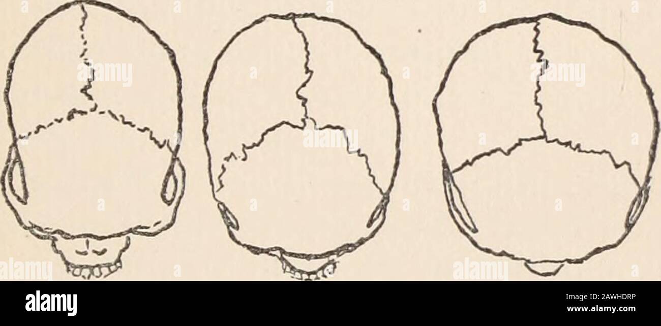 Archives of neurology and psychopathology. . ophilia of nucleolus. Figures / ?, 14 and /j.—Ganglion cells from the cerebral nuclei ofa guinea pig, killed by the toxines produced by growth in bouillon.Fixed and stained after the method of Nissl. Sketched with cameralucida, ocular 4, objective T5 oil immersion. Enlarged. Nuclear chromatophilia. Perinuclear chromatolysis, Figure 13.General cytoplasmic chromatophilia. Finely granular disintegra-tion of Nissl plaques. THE CEPHALIC INDEX. BV HENRY LYLE WINTER, M. D., Associate in Anthropology, Pathological Institute of the New York StateHospitals; I Stock Photo