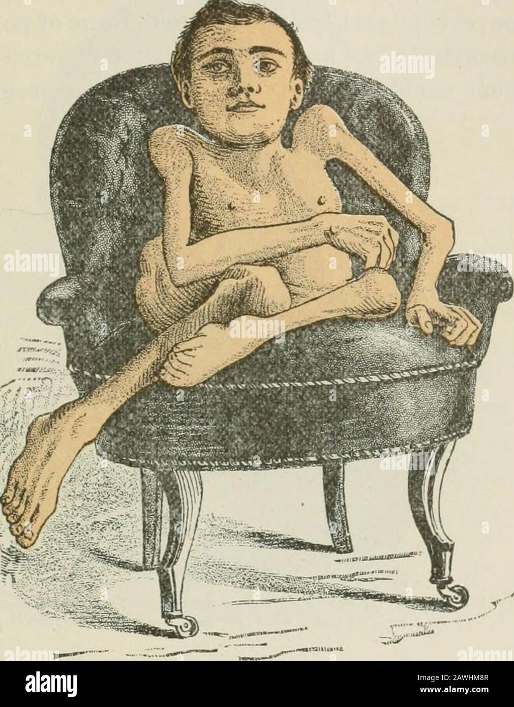 Lectures on nervous diseases from the standpoint of cerebral and spinal ...