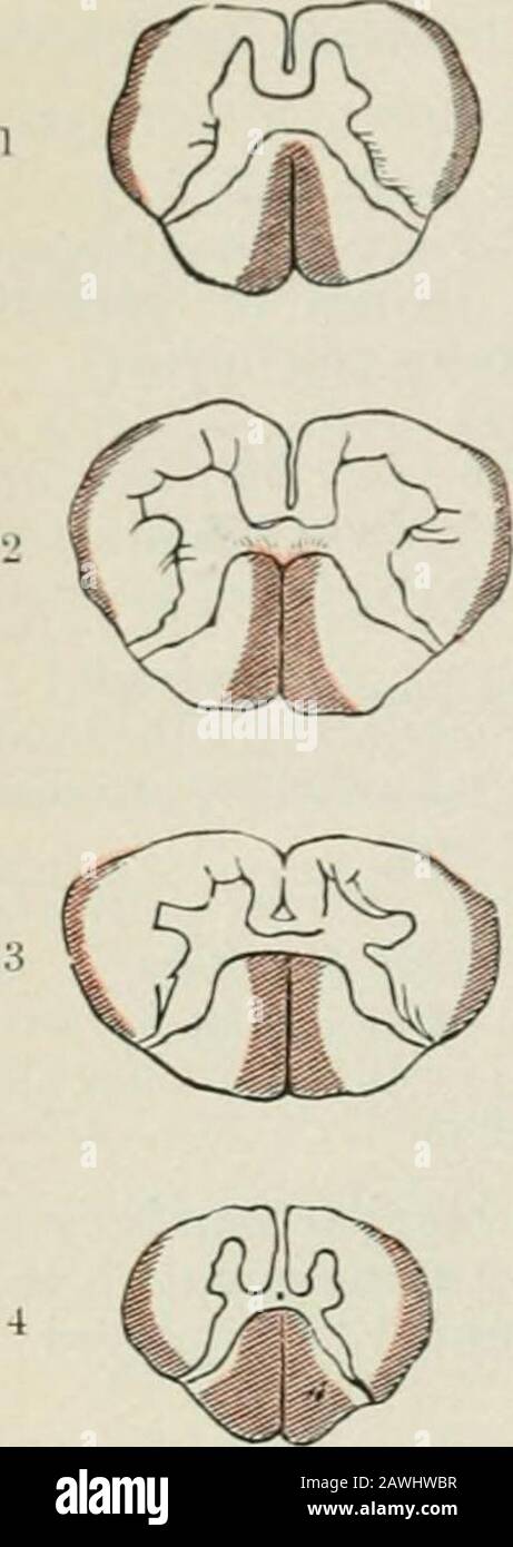 Lectures on nervous diseases from the standpoint of cerebral and spinal ...