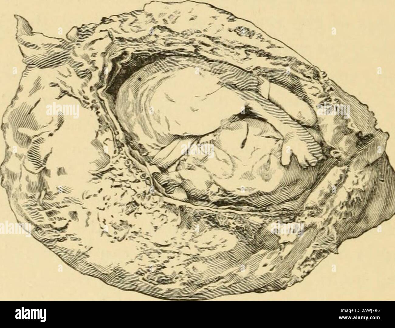 Embryo amniotic sac hi-res stock photography and images - Alamy