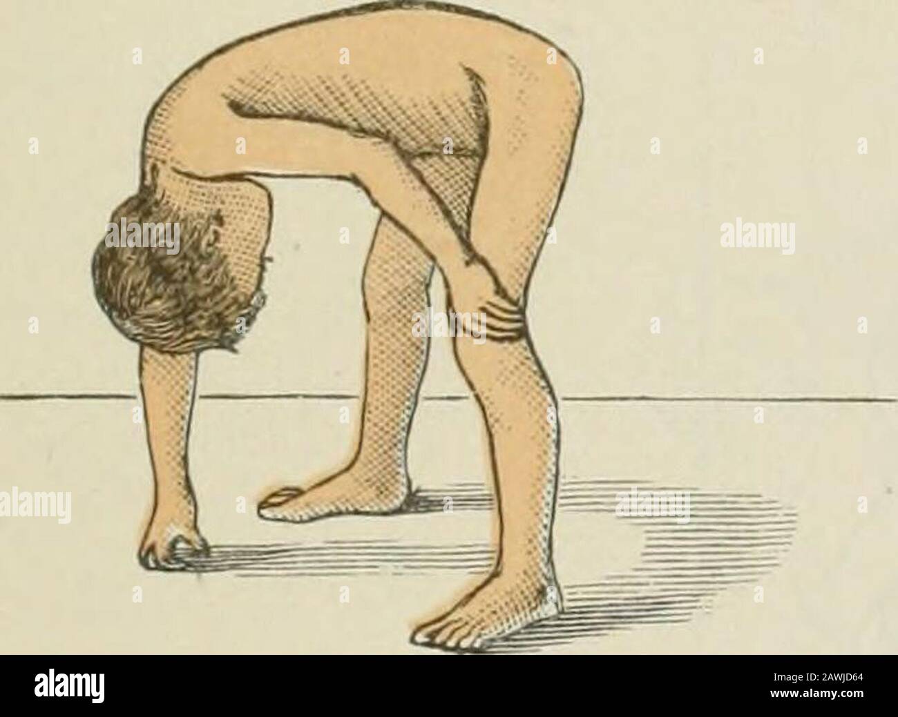 Lectures on nervous diseases from the standpoint of cerebral and spinal ...