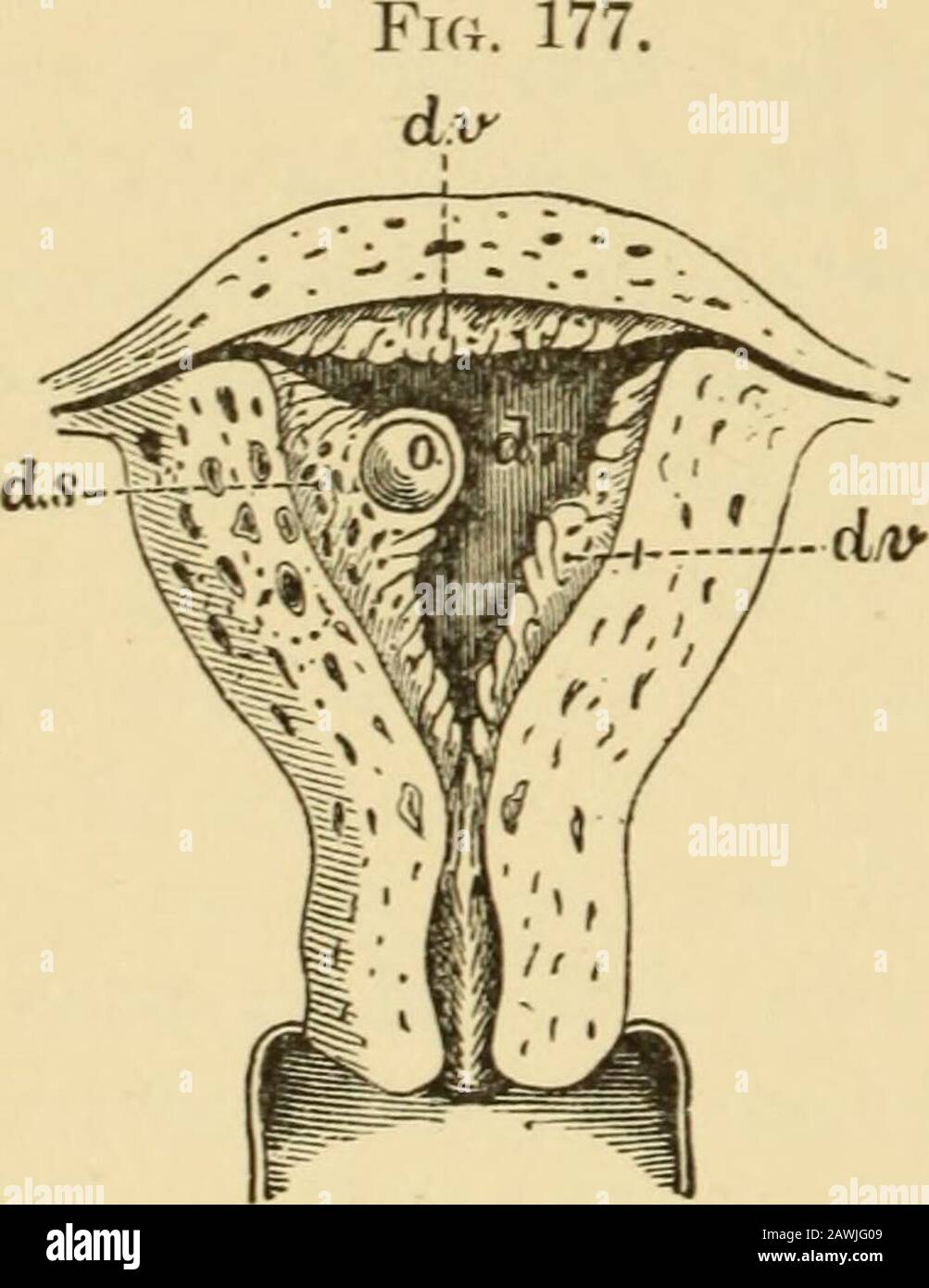 A system of obstetrics . iedlander, Kundrat,Leopold, Engelmann, and others have enabled us to follow the changesthat occur in the uterine mucous membrane from the entrance of theimpregnated ovule into the uterine cavity until the foetus, with itsenveloping membranes, is expelled at term. By the time the fertil-ized ovum arrives within the uterine cavity the lining mucous mem-brane of the uterus has become very much thickened,2 owing to a greatincrease in the interglandular connective tissue, which consists of enor-mously enlarged young connective-tissue cells, either closely pressedtogether or Stock Photo