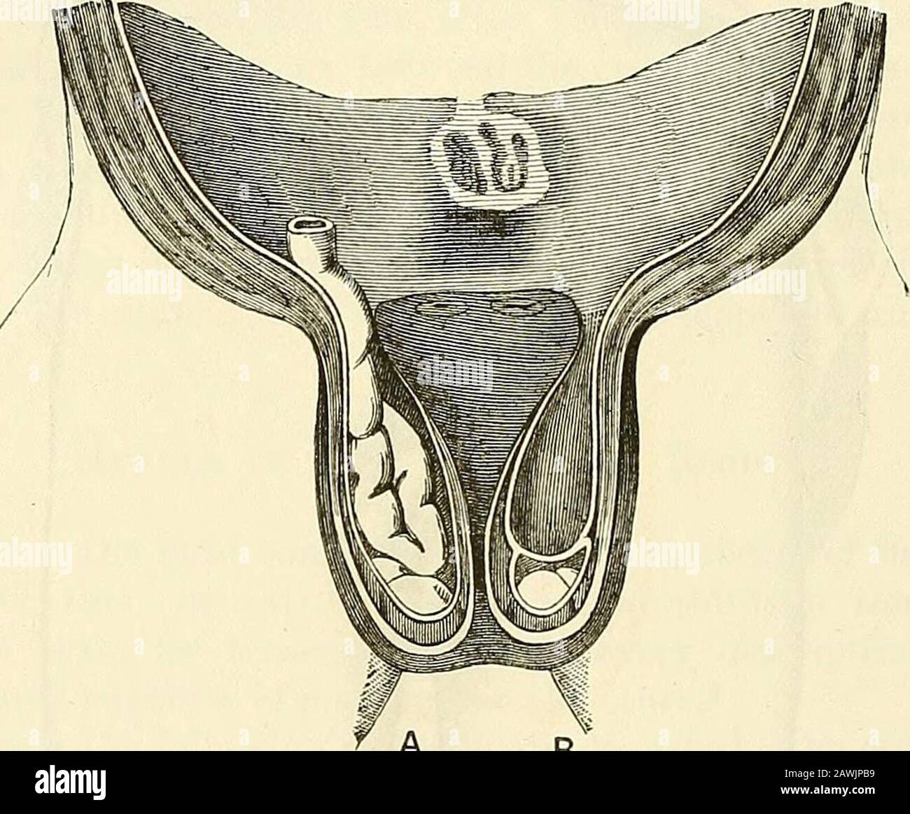 Pareunia A system of surgery : theoretical and practical . new formation. Its ...