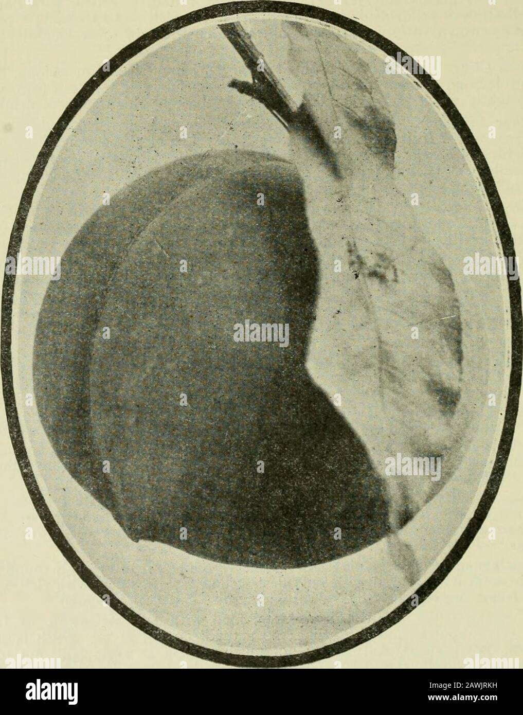 Apricotorchard hires stock photography and images Alamy