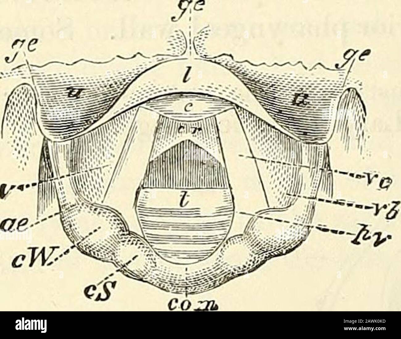 A system of surgery : theoretical and practical . The small escrescence situated on the right vocal cord (b) laight befalsely supposed to be on the left from the appearance presented inthe mirror (A). 660 DISEASES OF THE LARYNX. Fig. 148.. ge, Glosso-epiglottic folds ; w, uppersurface ; I, lip ; c, cushion of epiglot-tis ; V, ventricle of larynx; ree, ary-epiglottic fold ; cTF, cartilage ofWrisberg ; cS, capitulum Santorini;com, arytenoid commissure ; vc, vocalcord ; th, ventricular band ; py, pro-cessus vocaUs ; ci cricoid cartilage;?, rings of trachea. sively brought into view; the base of Stock Photo