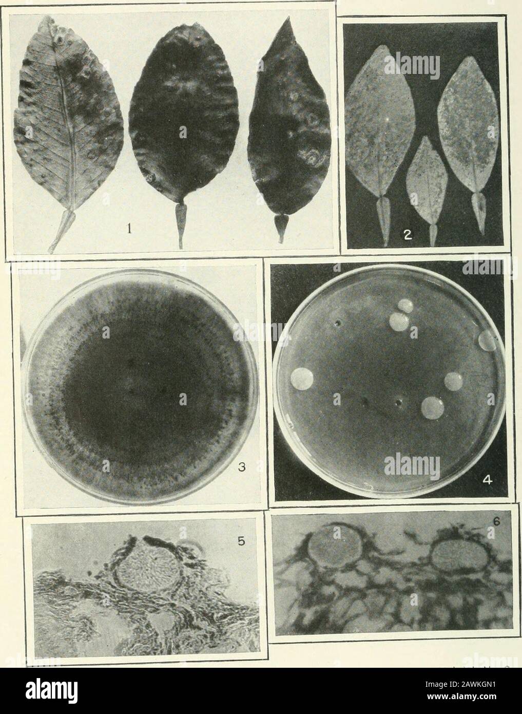 Journal of agricultural research . Journal of Agricultural Research Vol. VI, No.2 Citrus Canker Plate XI. Journal of Agricultural Research Vol. VI, No. 2 PLATE XI Fig. I.—Cankers on old grapefruit leaves which have enlarged during the secondgrowing season. Fig. 2.—Citrus canker resulting from immersion of leaves in a bacterial suspension.Lesions involving a large part of the lower leaf surface are thus formed. Fig. 3.—Culture of Phoma socia showing pycnidial formation in concentric rings. Fig. 4.—Dilution poured plate of Pseudomonas citri on green-bean agar. The spotson the colonies are the re Stock Photo