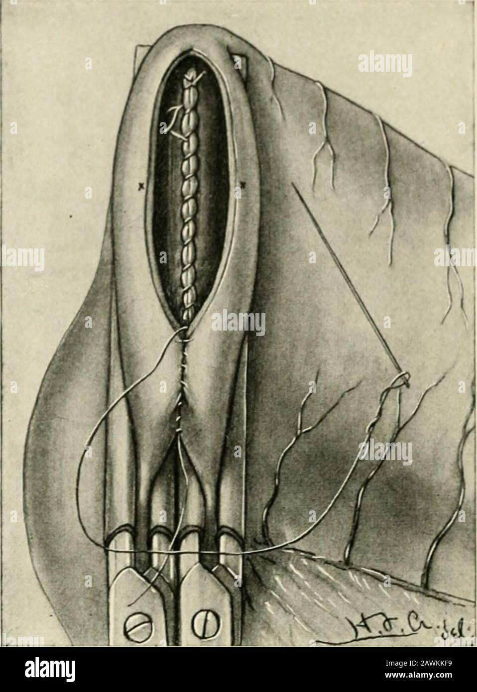 Tosew Hi-res Stock Photography And Images - Alamy