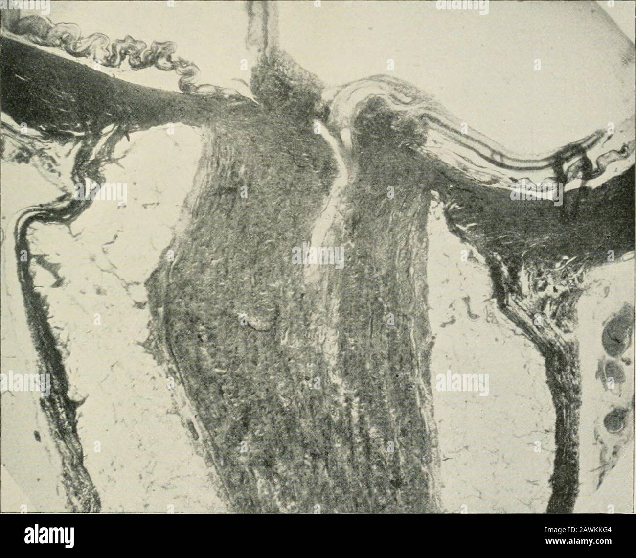 Connective tissue nerve hi-res stock photography and images - Alamy