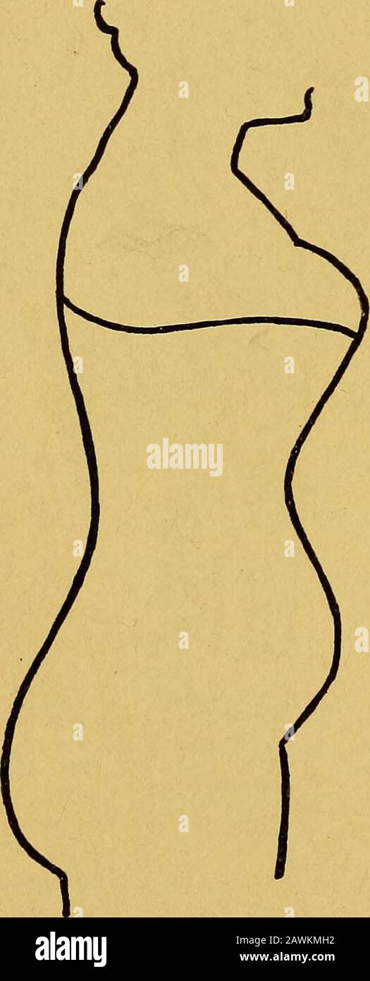 The posture of school children, with its home hygiene and new efficiency methods for school training . theupper part of the trunk bows over, asshown in Fig. 66. The stomach, intes-tines, and other organs are necessarilycrowded out of place, and indigestion,constipation, headaches, backaches, andmany ills that come from congestion andsluggish circulation are the inevitableconsequence. The so-called straight front corsethas wrought a great improvement in thisFig. 66. —Figure distorted one particular fault of corsct making, but by compression at the front of the waist. {Courtesy of most corsets a Stock Photo