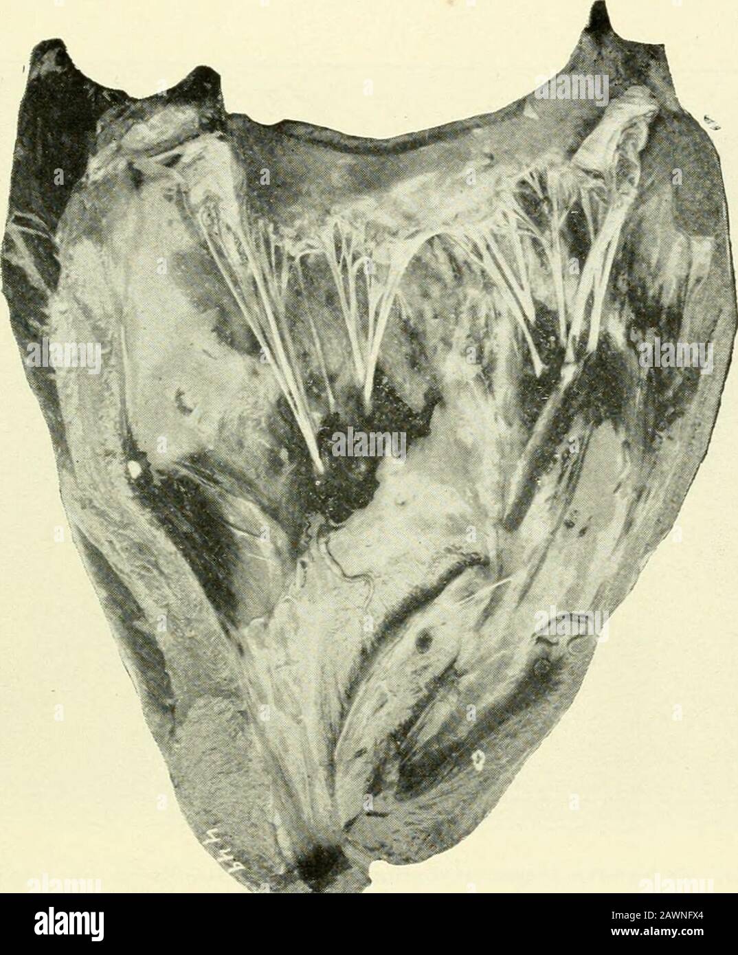 Annual report of the Agricultural Experiment Station of the University of Minnesota . Fig. 5—Hfemorrages on Costal Pleura. Bedor outbreak, autopsy No. 5,death No. 2.. Fig. 6.—Haemorrhages on Endocardium of Right Ventricle. Bedor out-break, death No. 2. Stock Photo