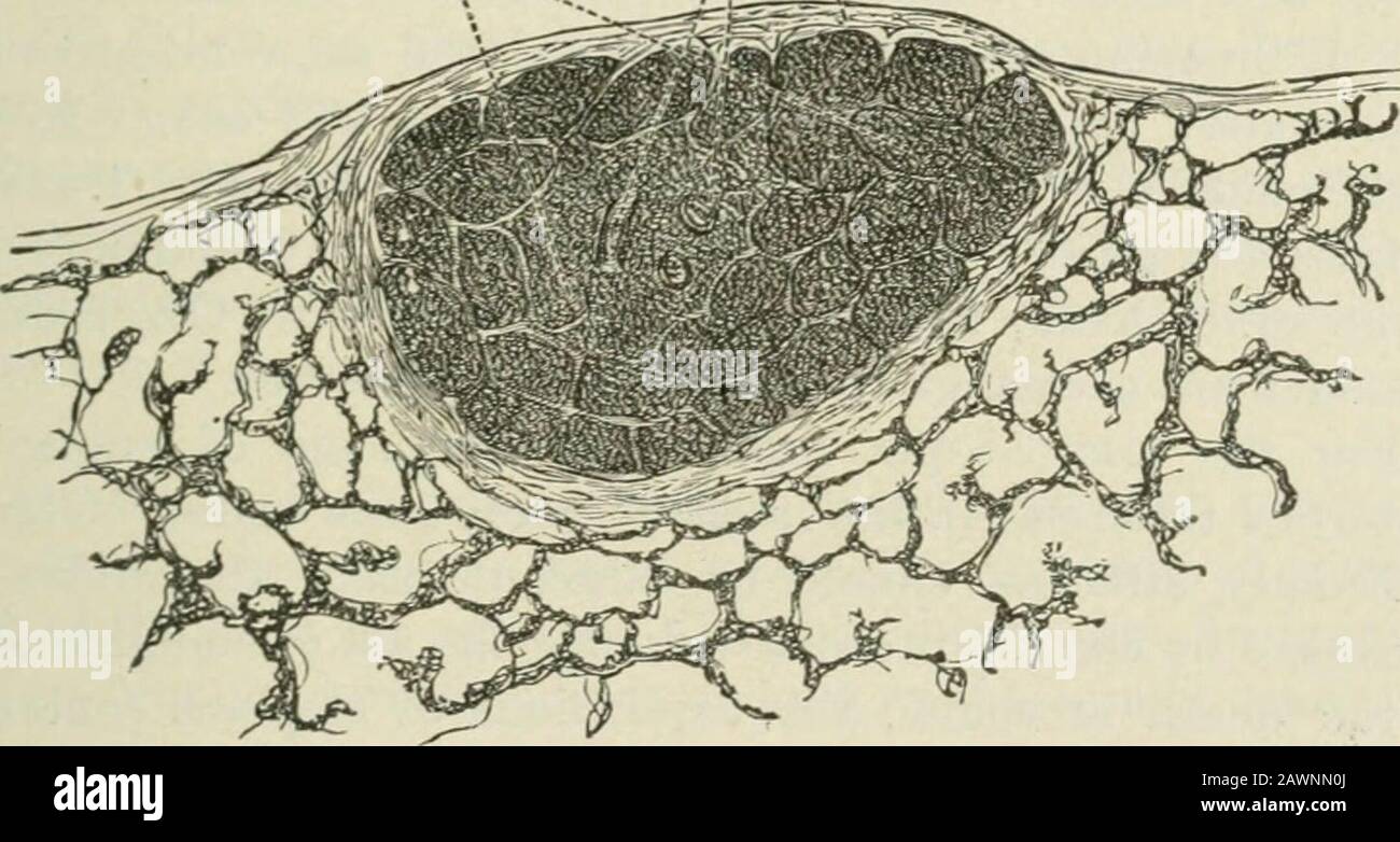 Handbook of meat inspection . bercles in question are distinguished macroscopicallyfrom glanderous tubercles by the absence of a red zone, by theirtendency to calcify, and farthermore by the homogeneous characterof the tubercles, the absence of small tubercles associated with. RESPIRATORY APPARATÜS 329 large ones, tbe abseuce of otlier glaudorous alterations, and by theiutepjrity of the bronchial glands. It slionhl l)e noted, however, thatthe tubercles in questiou maj appear in the lyinph ghmds. The etiology of these non-glanderous pulmonary tuberclesappears to be a variable one. In one case M Stock Photo