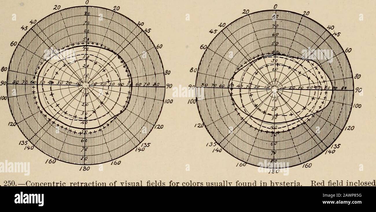 Macropsia hires stock photography and images Alamy