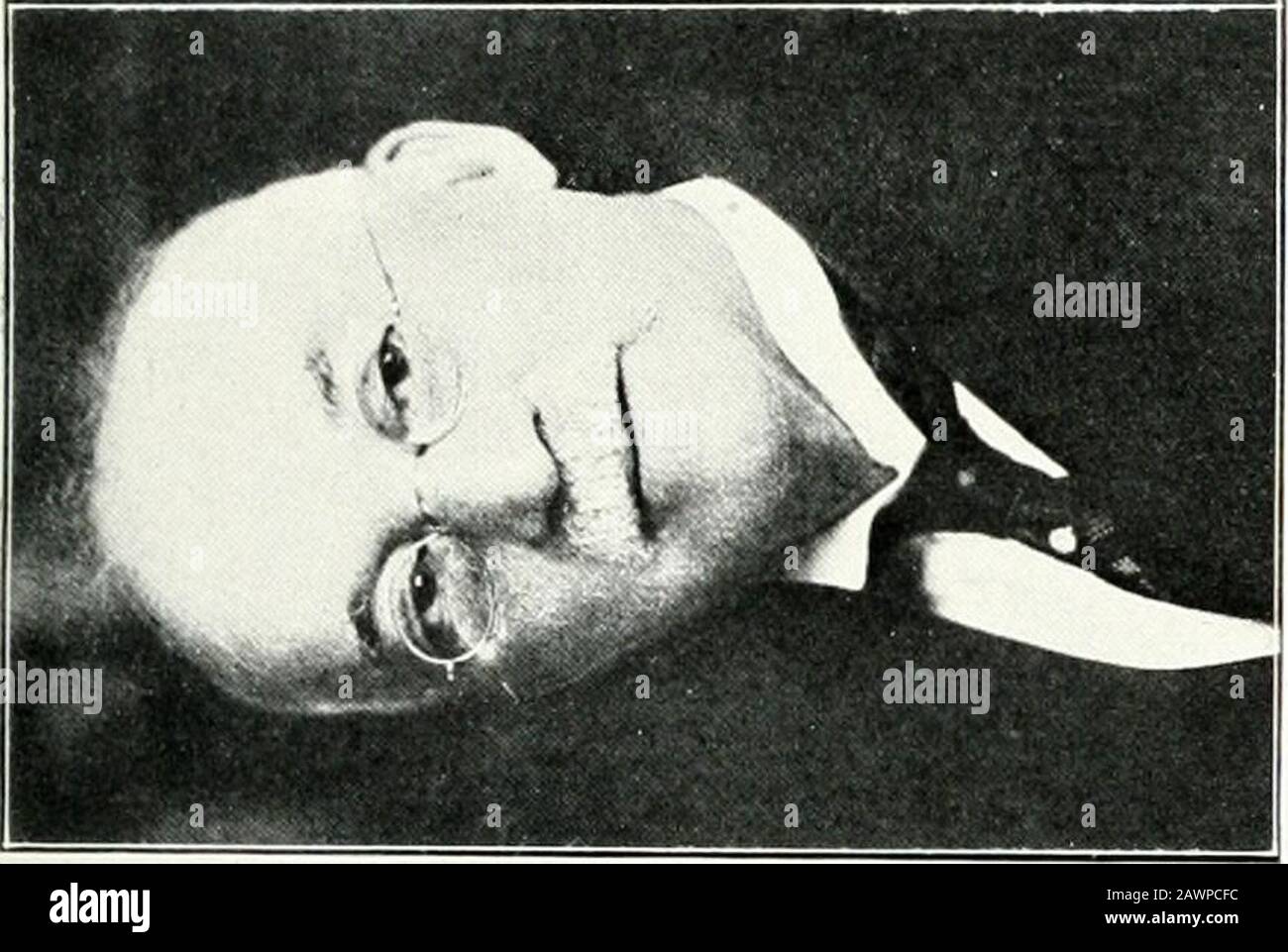 Page 429 N A R T High Resolution Stock Photography And Images Alamy