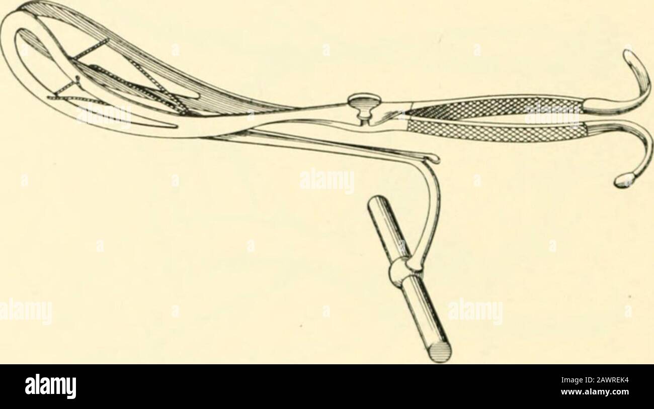 Axis traction forceps hires stock photography and images Alamy