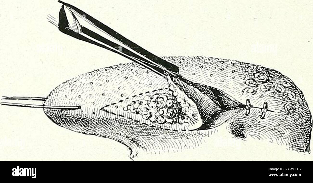 Ligature point hires stock photography and images Alamy