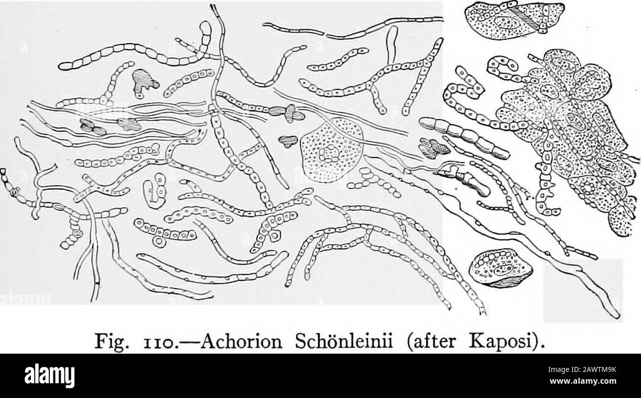 Essentials of bacteriology; being a concise and systematic introduction to the study of bacteria and allied microörganisms . cillium glaucum (X 500) (Frankel and Pfeiffer). walls break down, and the wind scatters the spores, leavingthe cap or columella behind. The rounded sporangium isusually black. Growth.—^Takes place at higher temperatures on acid media.It is not pathogenic. Achorion Schonleinii. Trichophyton Tonsurans.Microsporon Furfur.—^These three forms are similar toeach other in nearly every particular, and resemble in somerespects the Oidium lactis, in other ways, the mucors. The YE Stock Photo