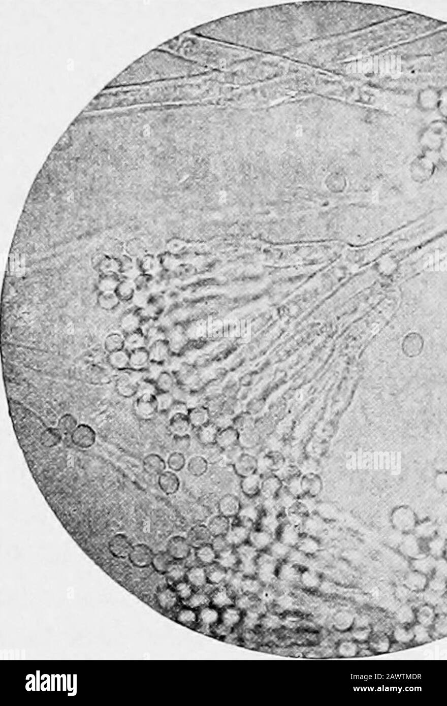 Essentials of bacteriology; being a concise and systematic introduction to the study of bacteria and allied microörganisms . ia g-ndculture-media. Form.—From the mycelium, hyphas spring which divideinto basidia (branches), from which tiny filaments arise(sterigmata), arranged like a brush or tuft. On each sterigmaa little bead or conidium forms, which is the spore. In thisparticular fungus the spores m mass appear green. Growth.—It develops only at ordinary temperatures, form-ing thick, grayish-green molds on bread-mash. At first theseappear white, but as soon as the spores form, the green pr Stock Photo