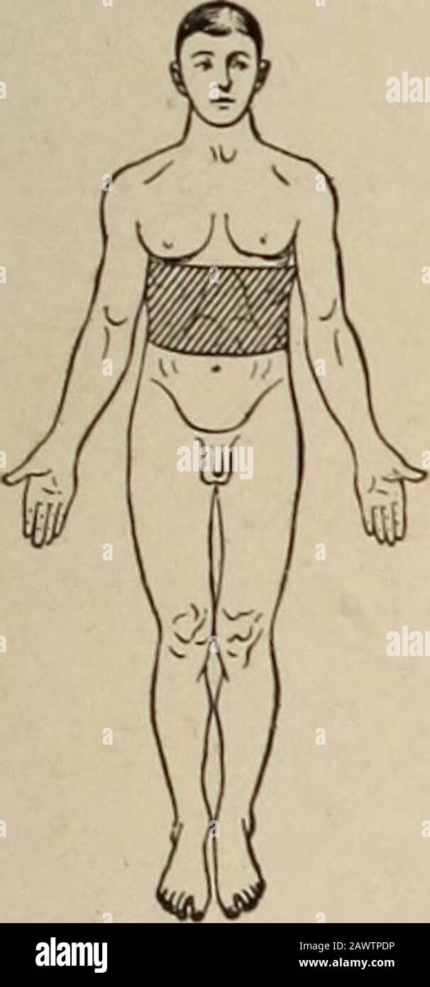 Nervous and mental diseases . scribed by the patient as the creeping of ...