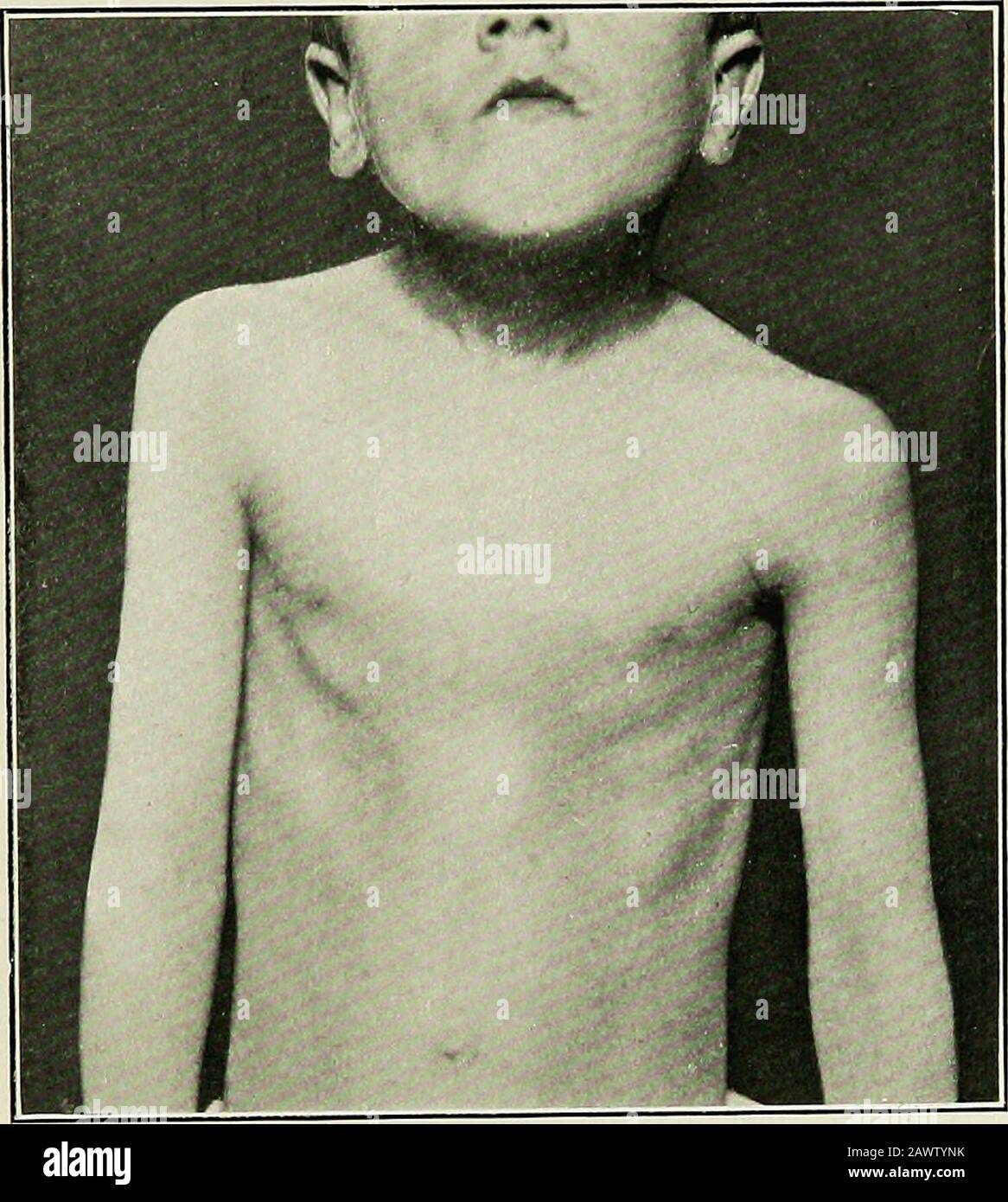 The medical diseases of children . ortunity for a