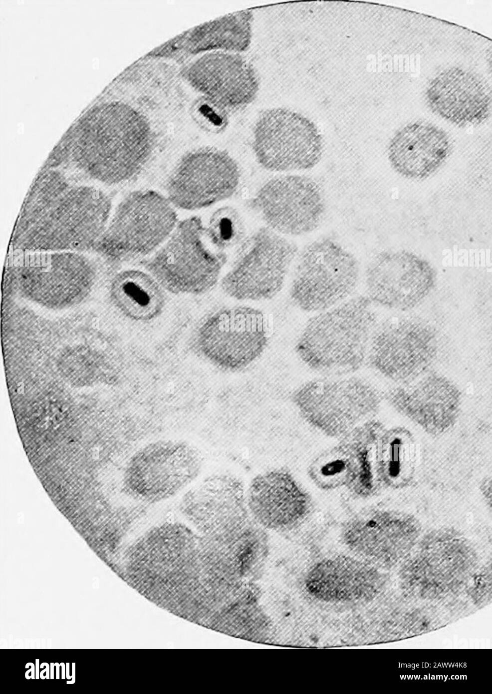 Essentials of bacteriology; being a concise and systematic introduction to the study of bacteria and allied microörganisms . Usually found inpairs, sometimes in filaments of three and four elements. Inthe material from the body a capsule surrounds each coccus.In the artificial cultures this is not found (Figs. 71 and 72). Properties.—^Variable in form, approaching the bacillaryt3rpe. Do not liquefy gelatin. There are no spores. Non-motile. Growth.—Best between 27° C. and 41° C, seldom below25° C. Facultative anaerobic. The culture-media must beslightly alkaline; the growth is slow. iS8 ESSENT Stock Photo