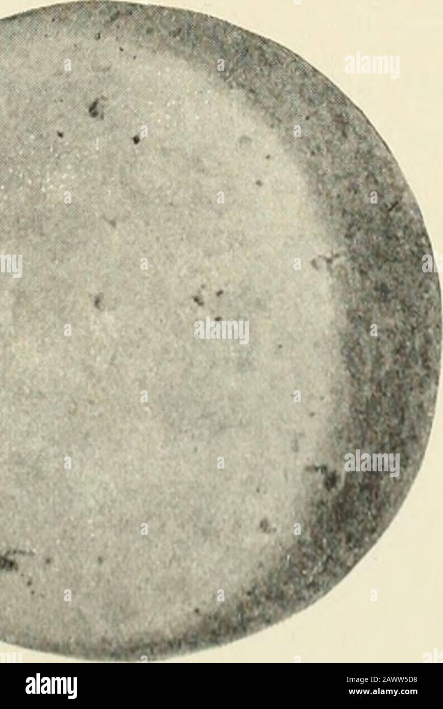 Annual Report Of The Bureau Of Ethnology To The Secretary Of The Smithsonian Institution Fig 100 Discoidal Stone Is Of Sandstone From Lauderdale County Alabama District O 03 Aw 6