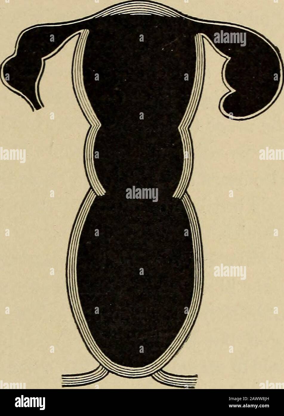 Can A Hermaphrodite Impregnate Themselves Telegraph