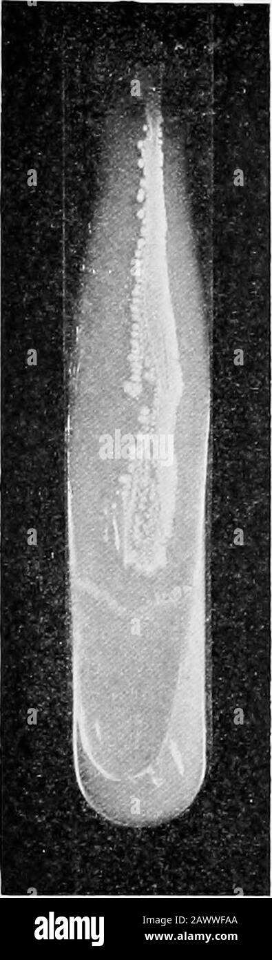 Essentials of bacteriology; being a concise and systematic introduction to the study of bacteria and allied microörganisms . (Fig, 54). On hlood-coagulum(see p. 72) the growth is usually grayand the margins of the culture crenated.Often a diagnosis can be made in fourhours if the serum-tubes are kept in theoven at 37° C. In milk, abundantgrowth, without curdling. Bouillon.—^In bouillon an abundantgrowth takes place, and this medium isused to obtain the toxins. Staining.—Is positive by Gramsmethod. Stained best with LoiSers al-kaline methylene-blue. Neissers doublestain (see p. 52) shows granu Stock Photo