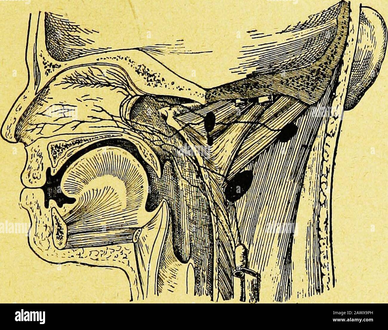 Phlegmon High Resolution Stock Photography And Images Alamy