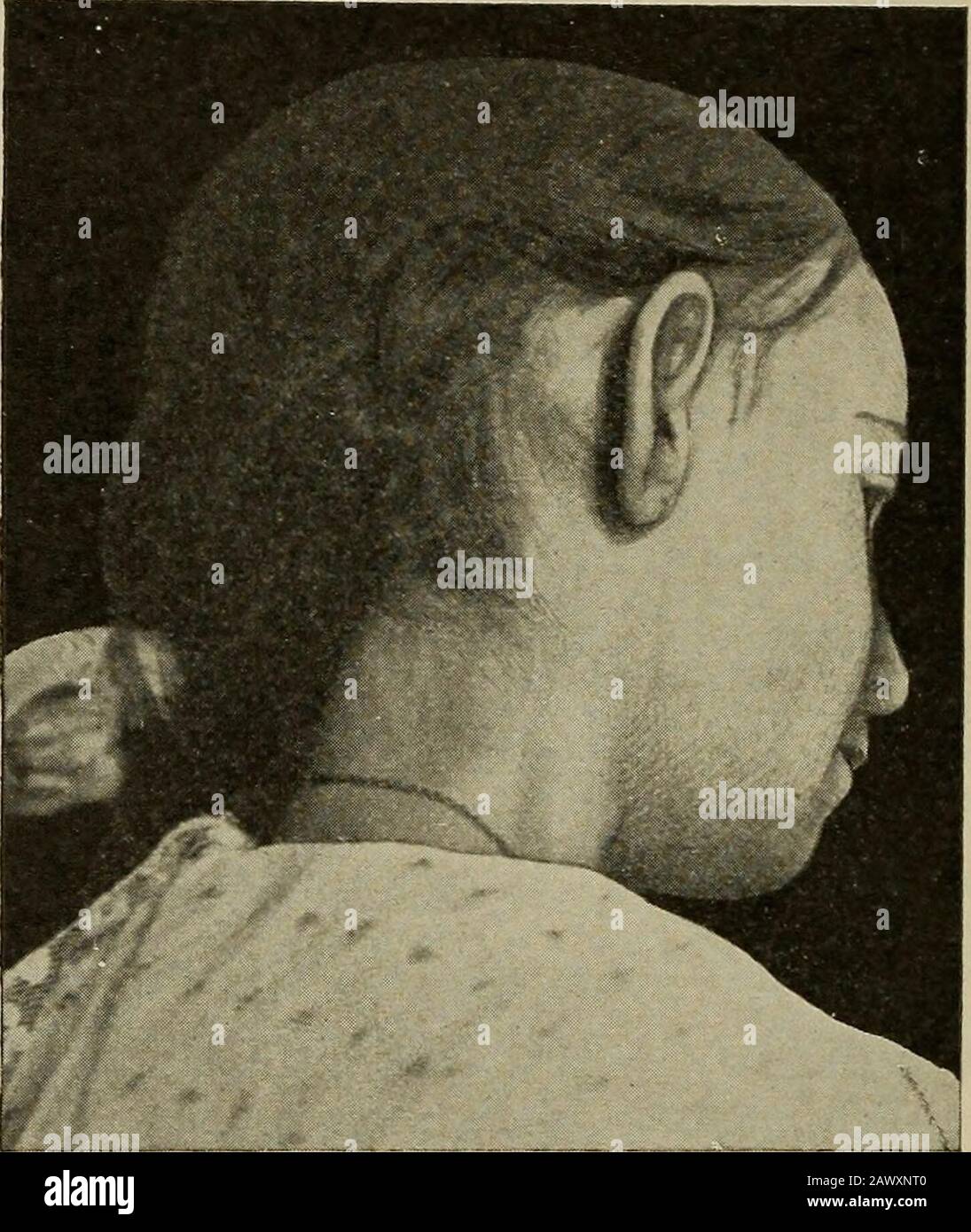 Drum cases hires stock photography and images Alamy