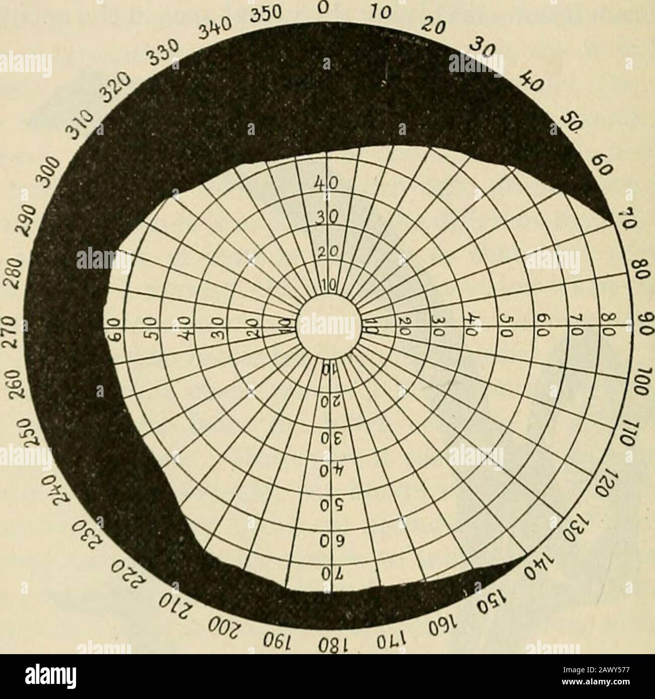 A text-book of physiology, for medical students and physicians . over the top of the verticalrod at the right at a fixed point in the middle of the semicircular bar. The extent and portion of the retina affected may be used to aid inlocating the seat of the lesion. For physiological and for clinicalpurposes it is necessary to distinguish between the central (or direct)and the peripheral (or indirect) fields of vision. The former termis meant to refer to that portion of the field which falls upon thefovea centralis; in other words, it is the projection, in any fixed 334 THE SPECIAL SENSES. posi Stock Photo