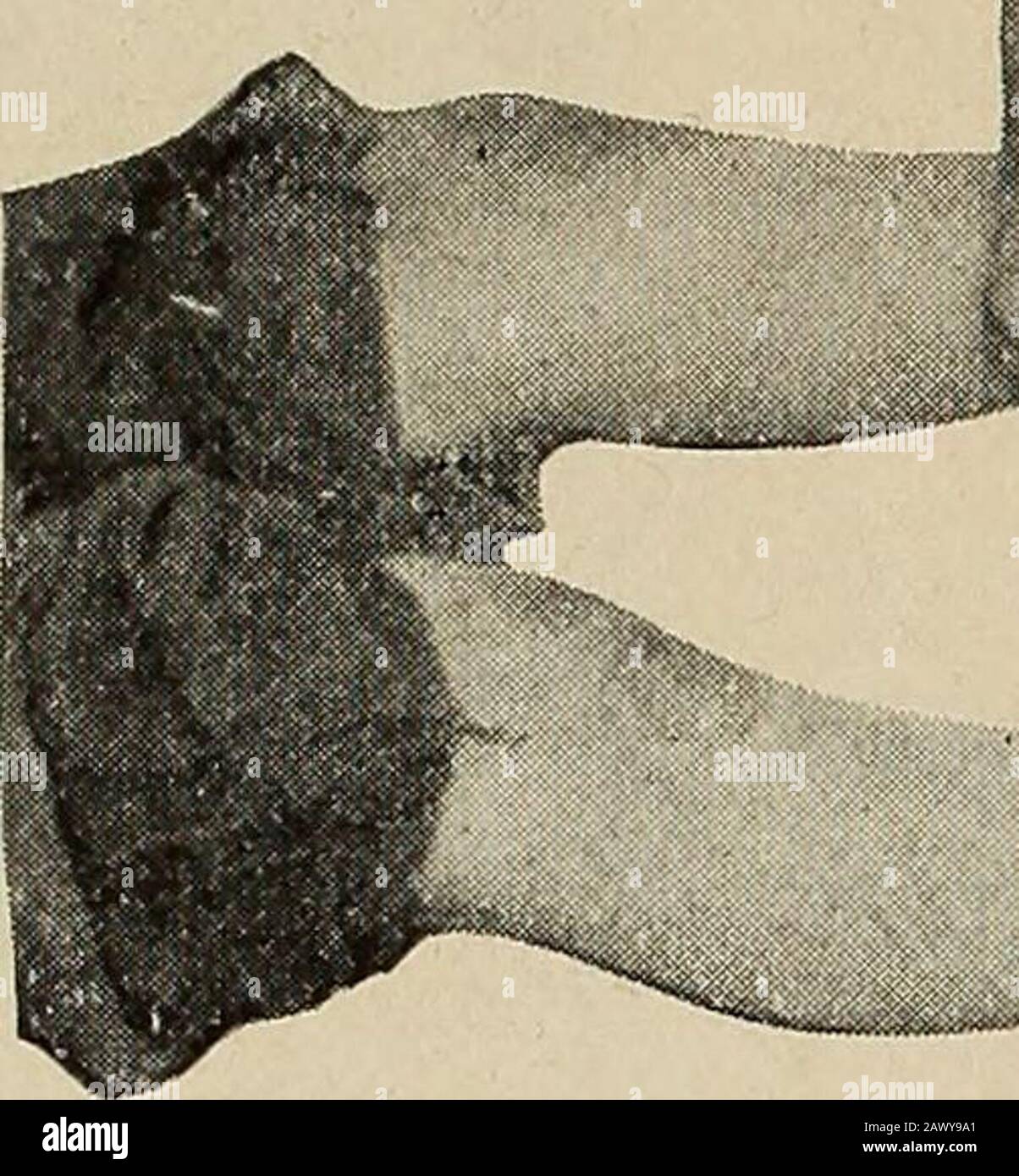 Nervous and mental diseases . The more extensiveinjury to the brain is ...