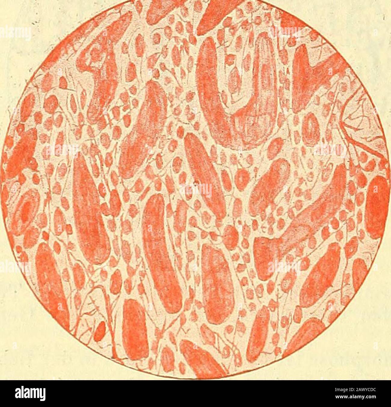 Nekrose hires stock photography and images Alamy