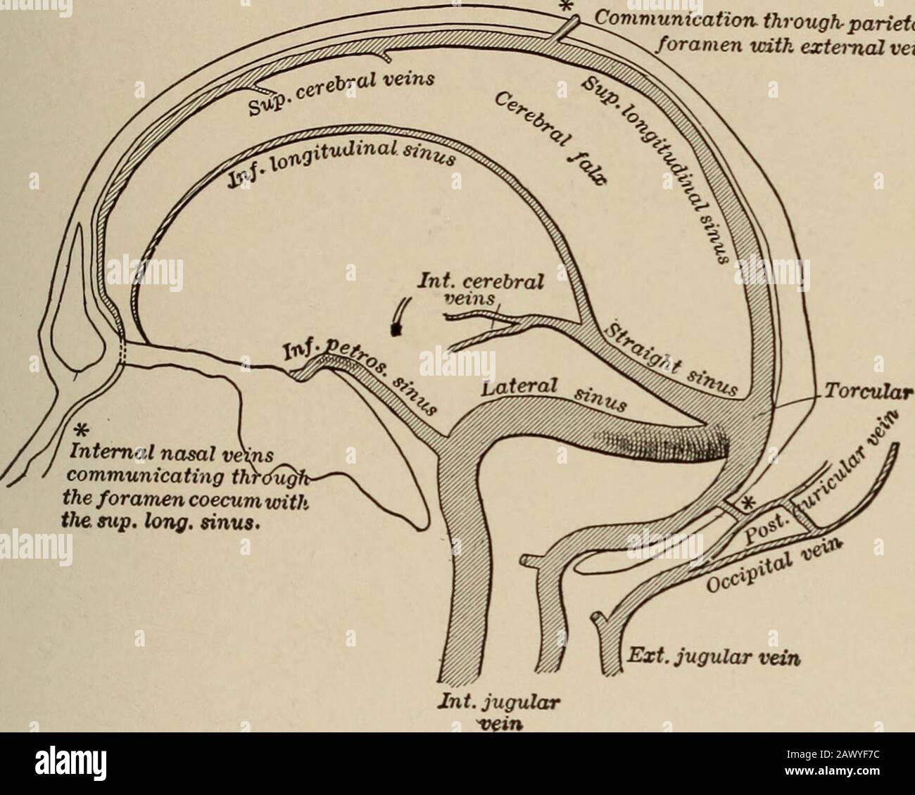 Nervous and mental diseases . ity of recurrence.When the paralytic state is established, its management is the same asthat laid down in the previous chapter, and for the terminal monoplegiaor hemiplegia the indications are likewise identical. The treatment ofaphasias and the development of the opposite-sided speech-centers havebeen described in the chapter on Aphasia. DISEASES OF THE CEREBRAL VEINS AND SINUSES, 227 CHAPTER VIII.DISEASES OF THE CEREBRAL VEINS AND SINUSES. Anatomical Considerations.—The blood entering the cranium bythe internal carotids and vertebrals after irrigating the enceph Stock Photo