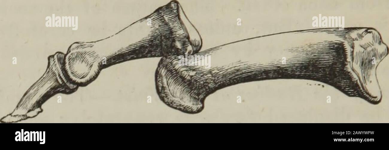 Thumb dislocation hi-res stock photography and images - Alamy