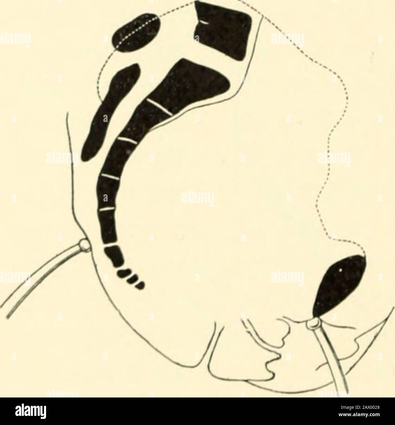 A textbook of obstetrics . imation of the tuberosities of the ischia, the depth of the pelvis, and the direction of itscanal ; by detecting, possibly, thepresence of an exostosis, an osteo-sarcoma, an abnormally project-ing spinous process, an old frac-ture, or asymmetry of the pelvicwalls from any cause. Measurement of the Trans-verseDiameter of the Pelvic Outlet.—Theanteroposterior diameter of the in-ferior strait is enlarged during laborby tin- displacement backward ofthe coccyx. The transverse diam-Fig 281.-Measurement of the eter betweeil the tuberosities ofanteroposterior diameter i the Stock Photo