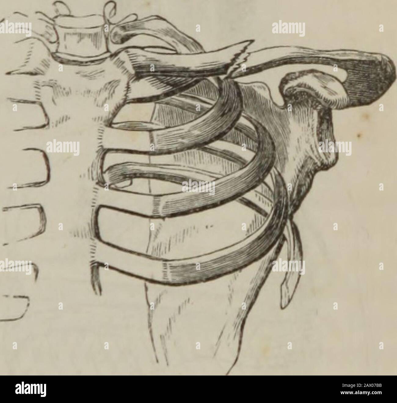 The practice of surgery . drag-ged downwards by the weight of thearm, and forwards and inwards by the action of the subclavius, the attachment of this muscle to the firstrib being then the fixed point. [When the point of fracture is near the acromial extremity, wherethe bone is broad, there may be no displacement at first, and but little,perhaps, at any subsequent period. This is owing, partly to the breadthof the bone, and partly to the existence of ligamentous fibres, unrupturedby the violence, which hold the fragments in apposition. Frequently,however, unless the accident is recognized and Stock Photo