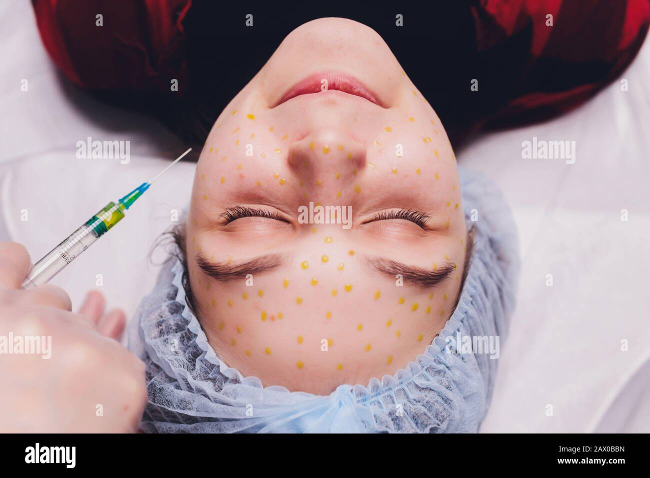 The doctor cosmetologist makes the biorepil facial injections procedure ...