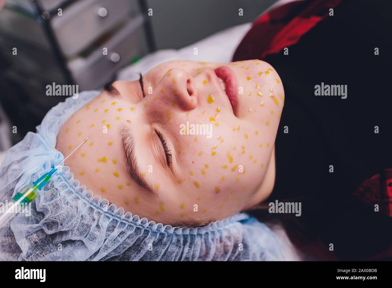 The doctor cosmetologist makes the biorepil facial injections procedure ...