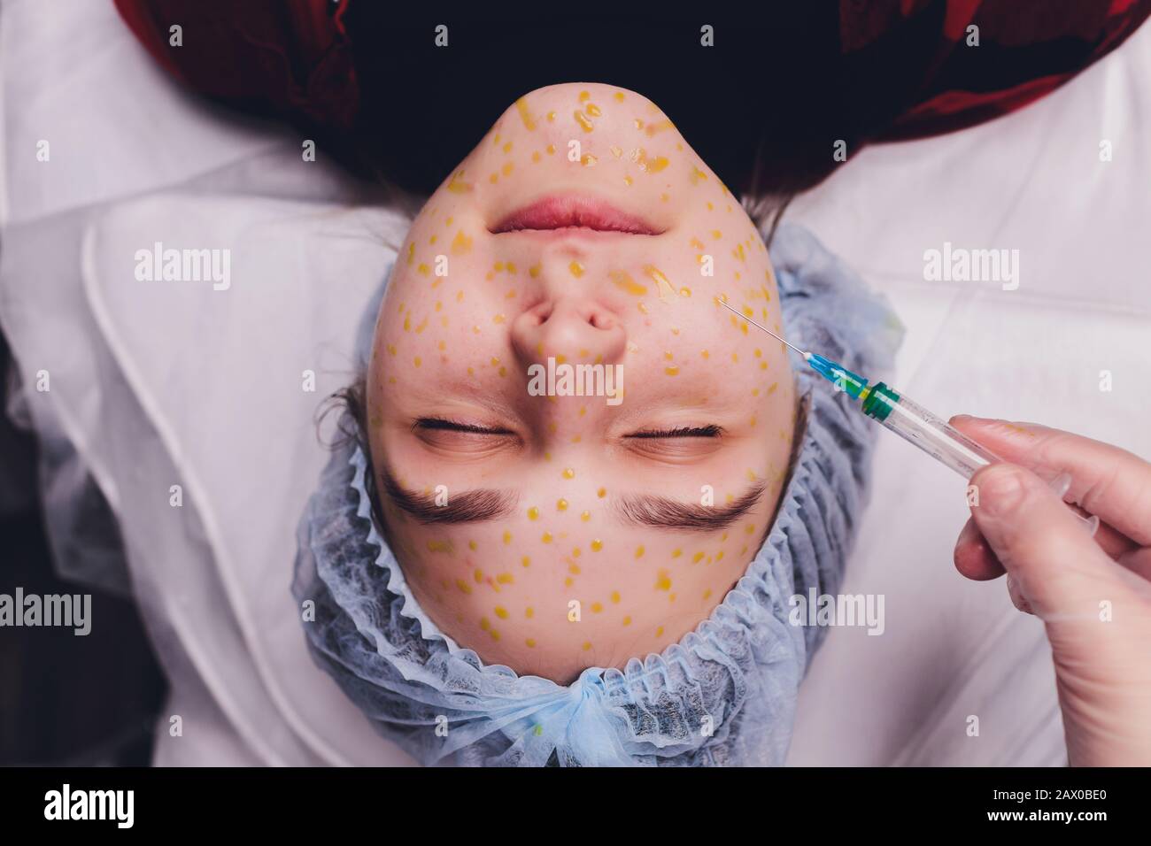 The doctor cosmetologist makes the biorepil facial injections procedure ...