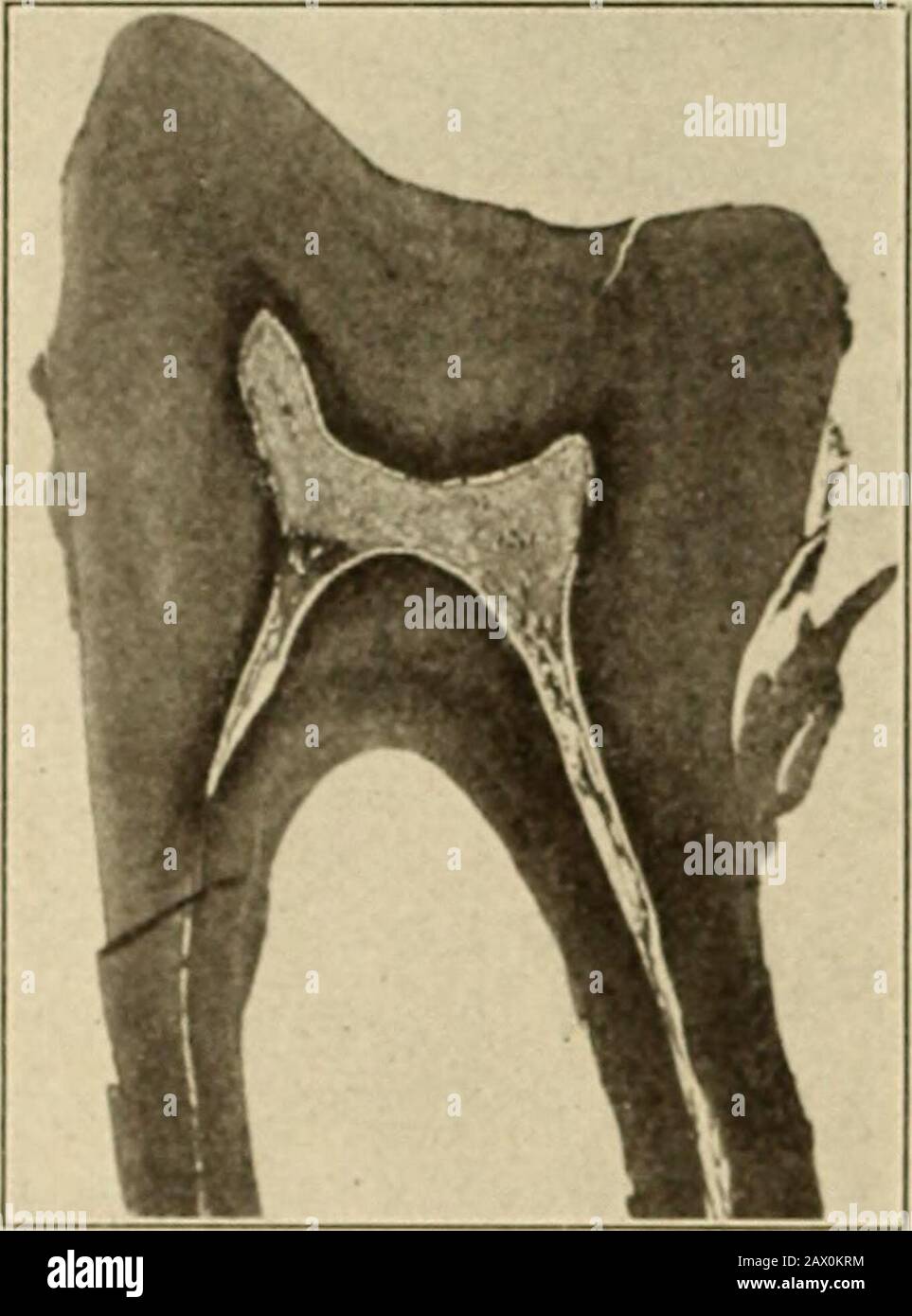 Hatchet teeth i hires stock photography and images Alamy