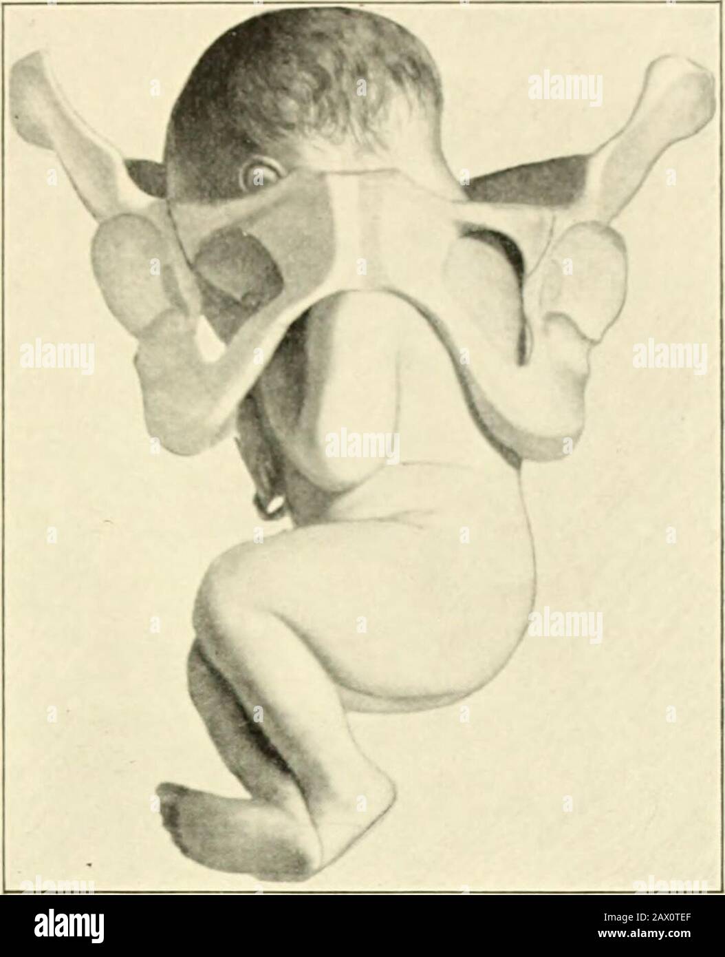A textbook of obstetrics . I Fig. 2]