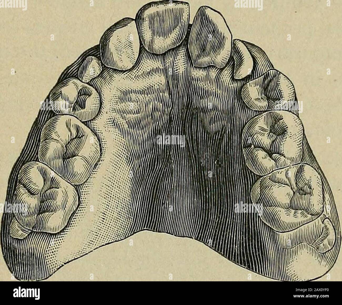 Automorphic Cuspidal The etiology of osseous deformities of the head, face, jaws and teeth ...